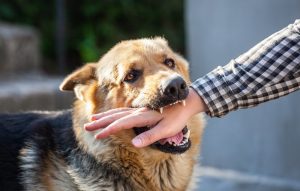 How a Dog Bite Lawyer Can Safeguard Your Rights and Recovery