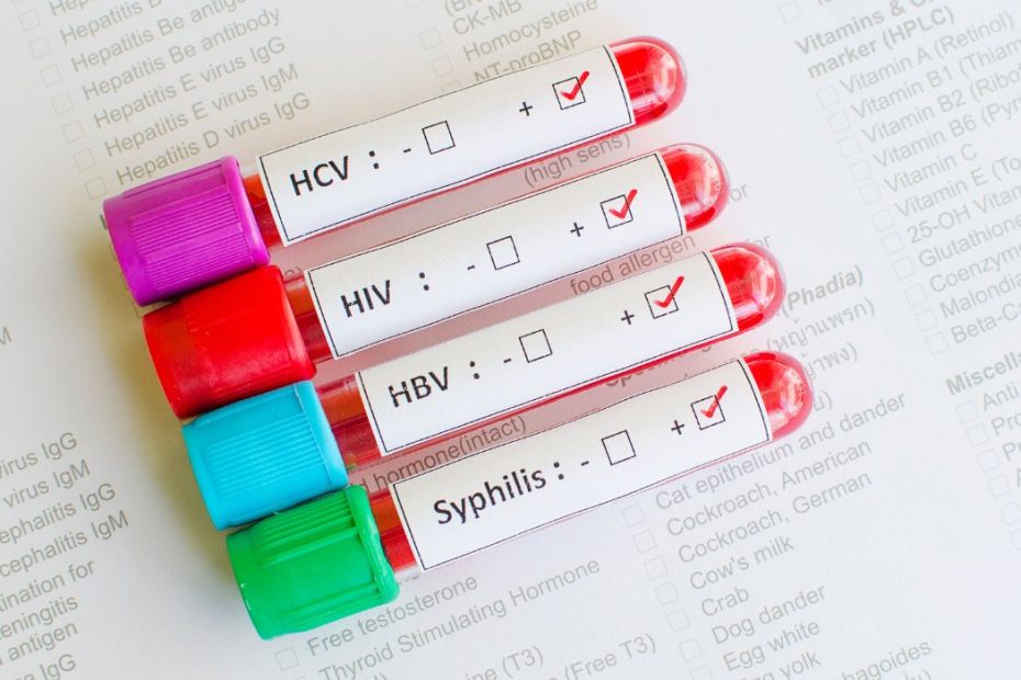 lyme disease test kit